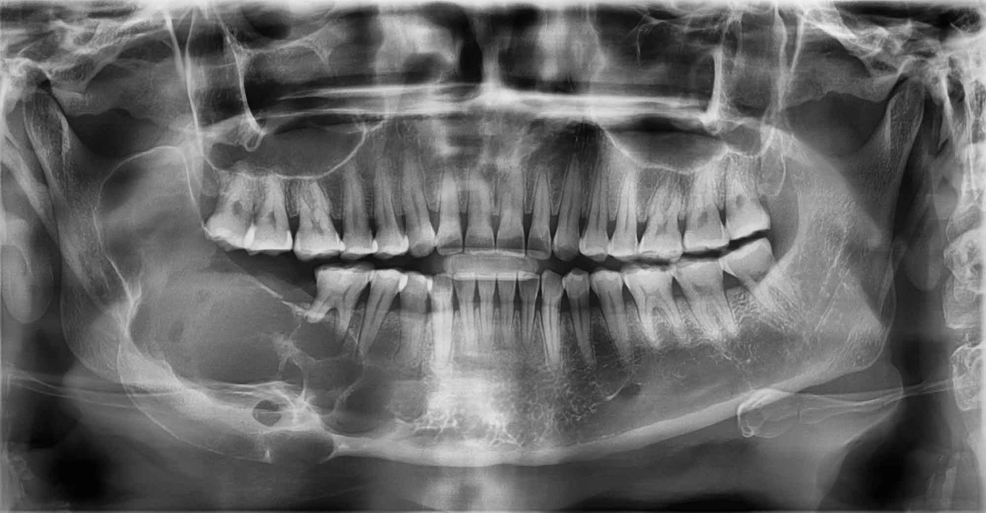 Head and Neck Pathology